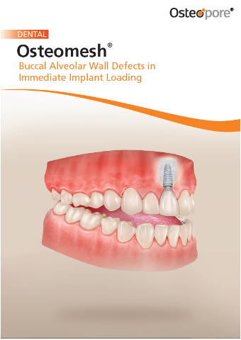 Brochure Immediate Implant Loading
